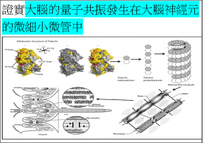 Brain證實大腦的量子共振發生在大腦神經元的微細小微管中